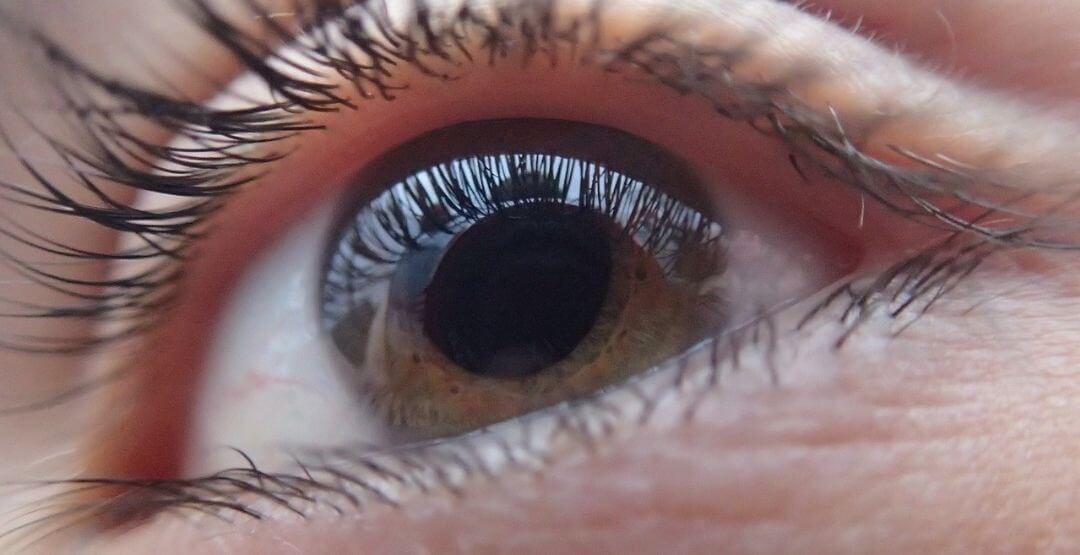 olhos e infarto