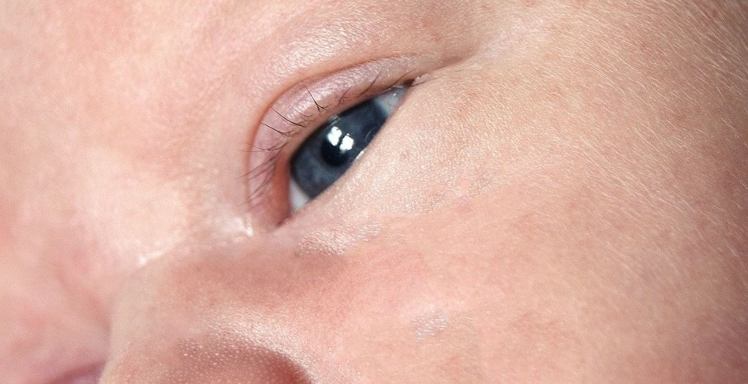 Veja como identificar e tratar a conjuntivite neonatal por clamídia
