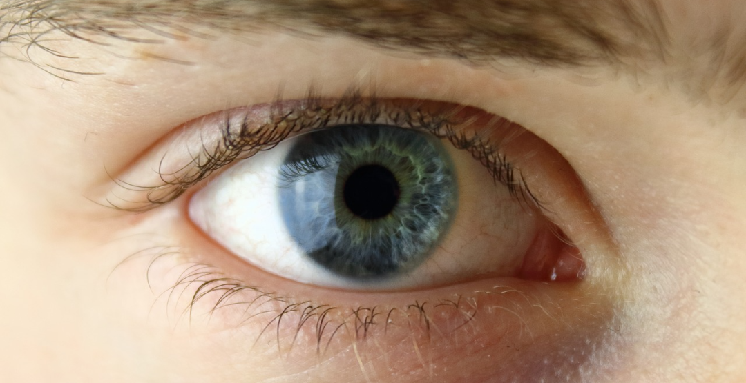 Saiba como diagnosticar a retinopatia pelo HIV