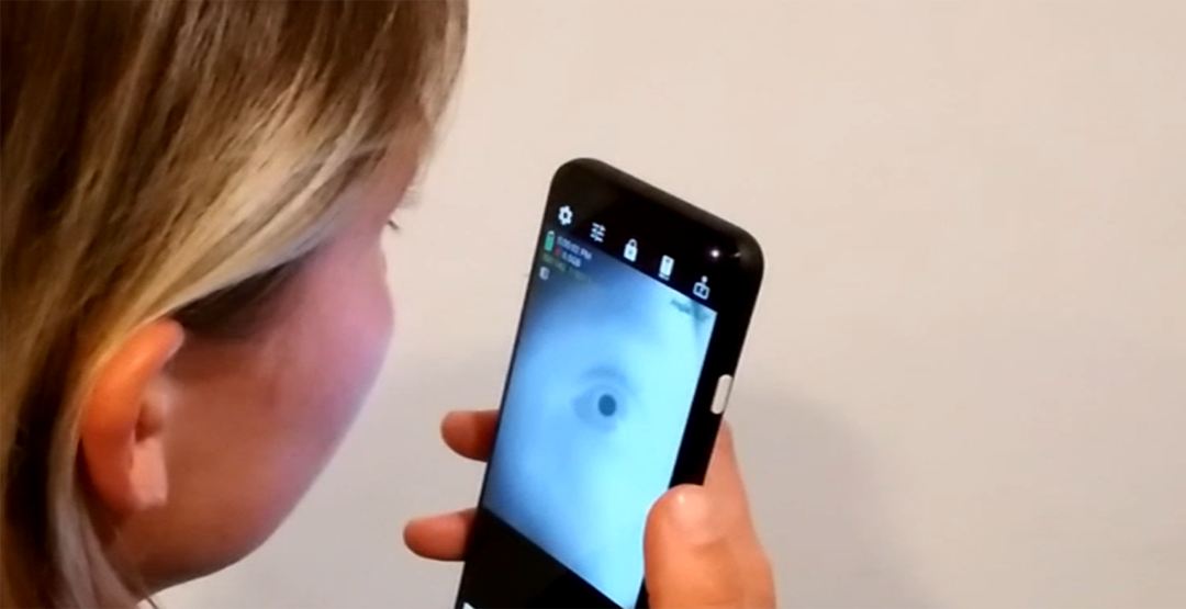 Aplicativo de celular pode identificar Alzheimer por meio de selfie do olho