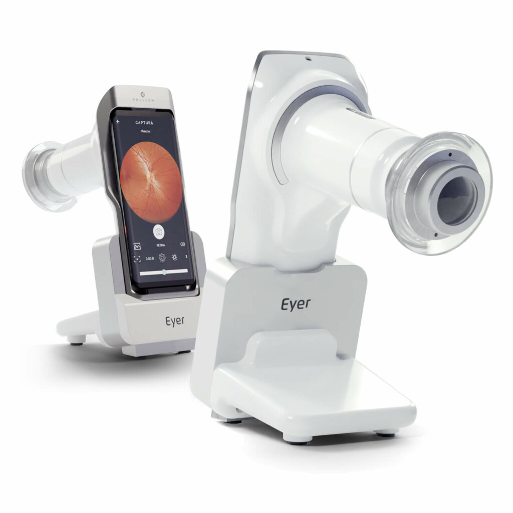 Retinal Camera Eyer