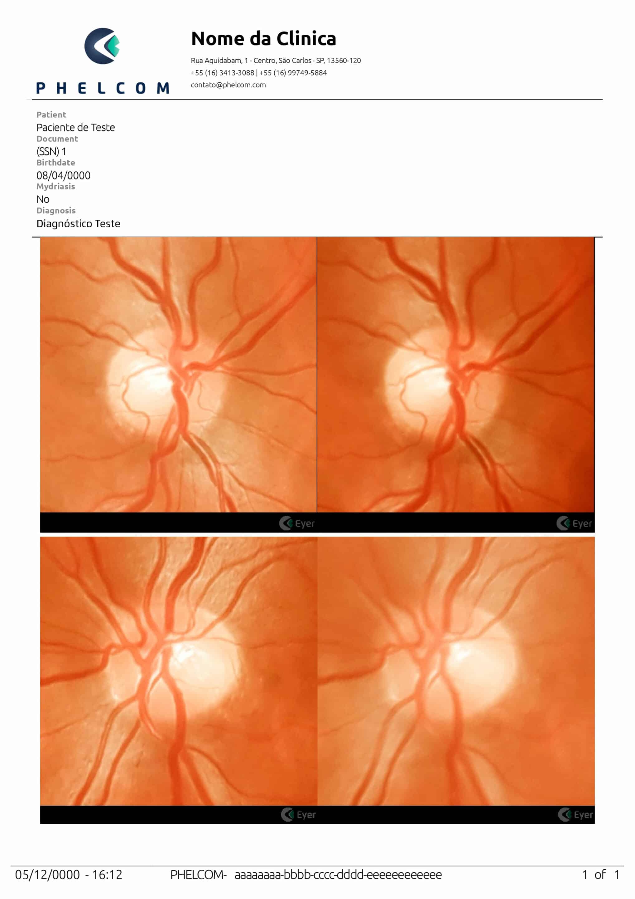 Img Laudo Glaucoma 1