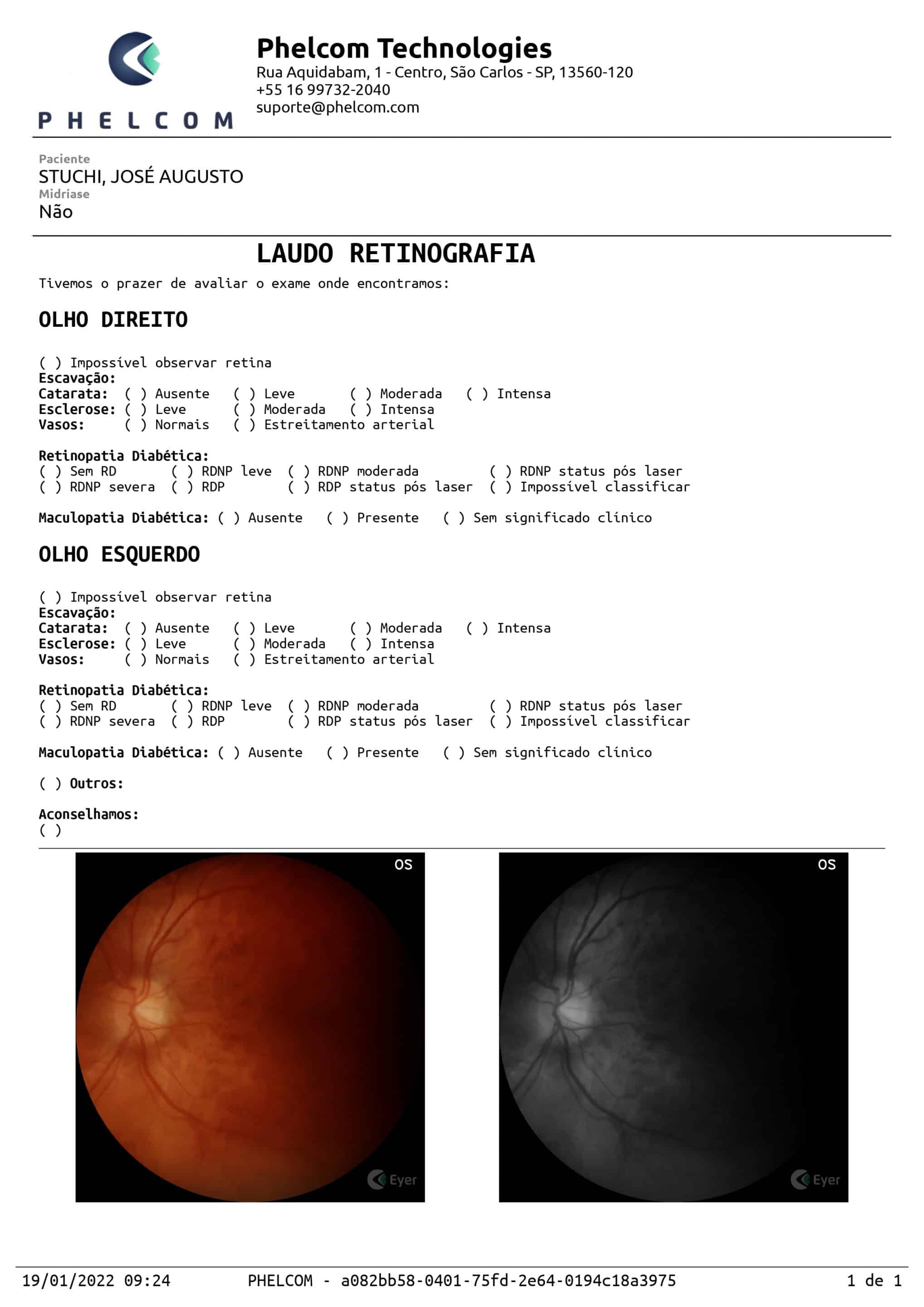 Img Laudo Glaucoma 2