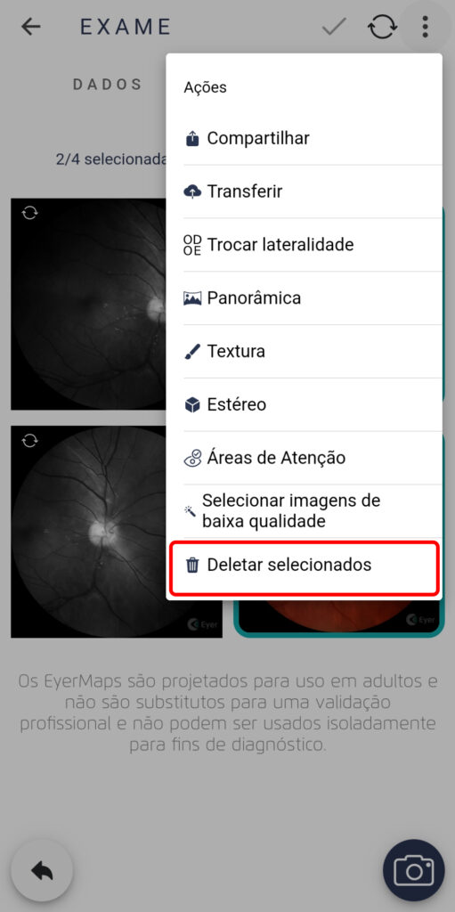 Faq Como Excluir Uma Imagem 5 1