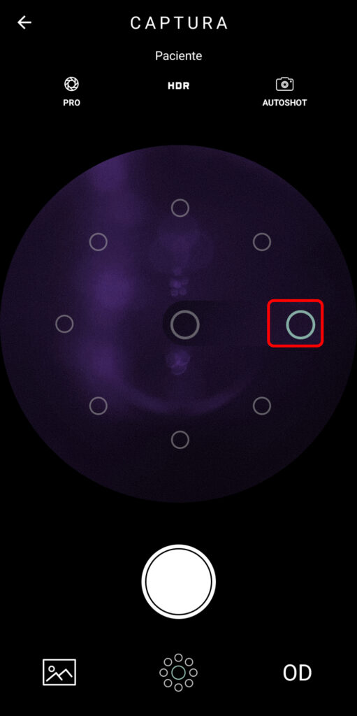 Faq Como Realizar Captura Com Macula No Centro Da Foto 1 1