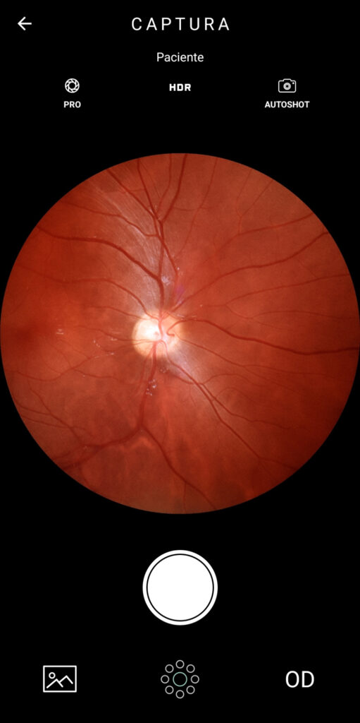 Faq Como Realizar Captura Com Macula No Centro Da Foto 3 1