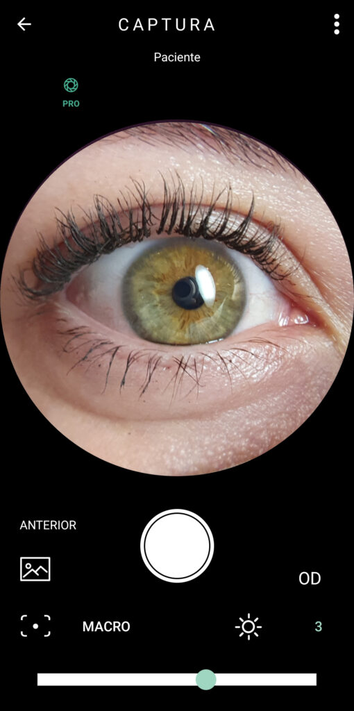 Faq Como Realizar Captura De Segmento Anterior 3 1