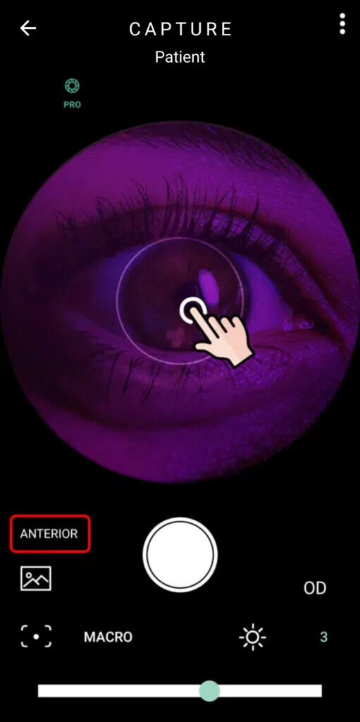 Faq How To Capture Images Of The Anterior Segment 01