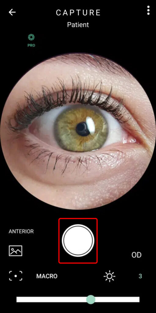 Faq How To Capture Images Of The Anterior Segment 02
