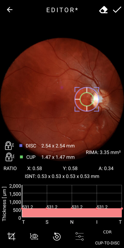 Faq What Is The Cdr Measurement 03