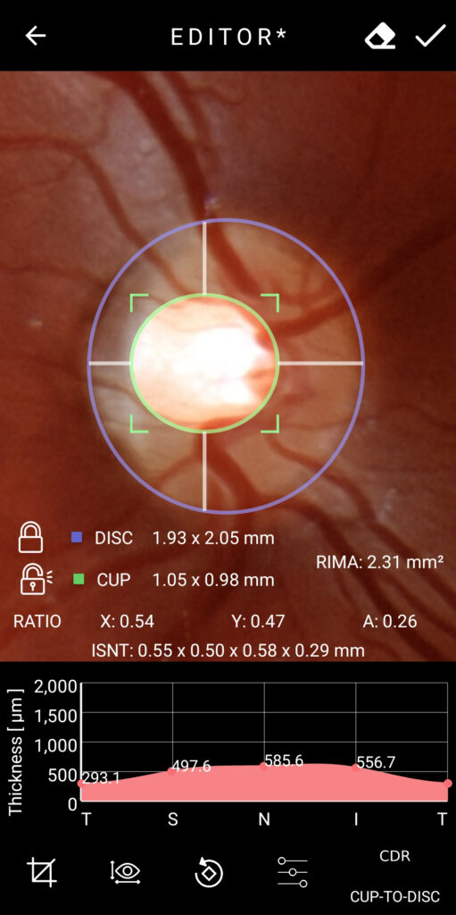 Faq What Is The Cdr Measurement 04