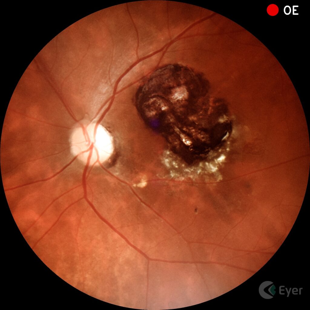 Exame Puc Bh De Olhos Para O Futuro