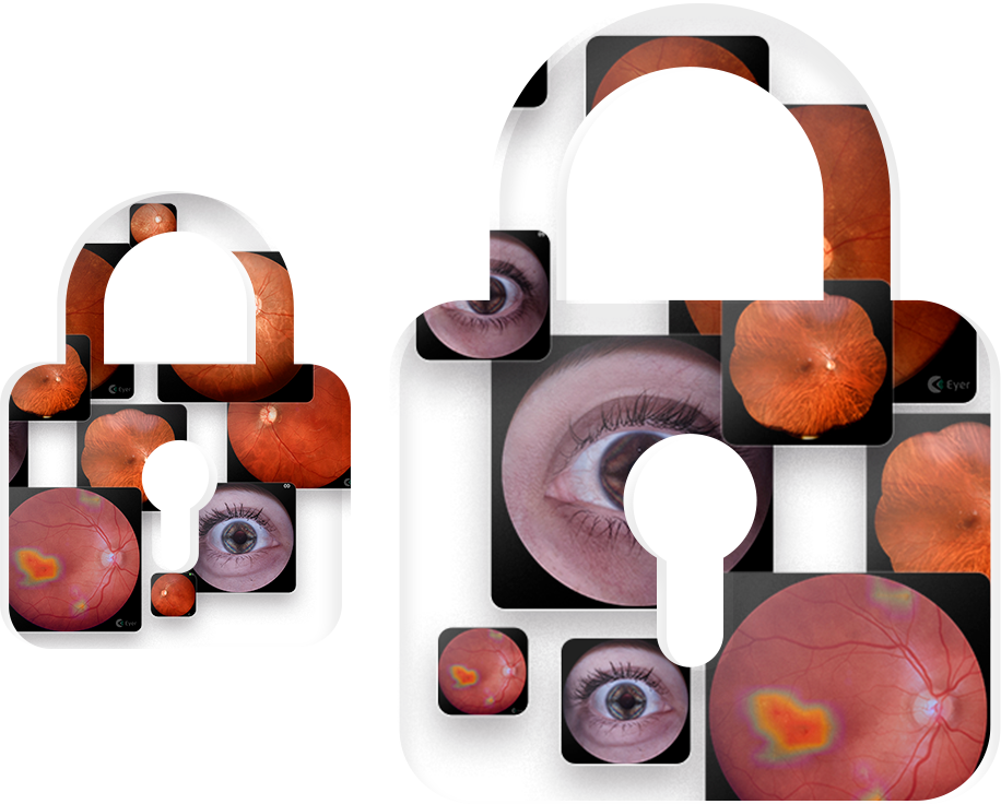 Img Eyer Cloud Safe
