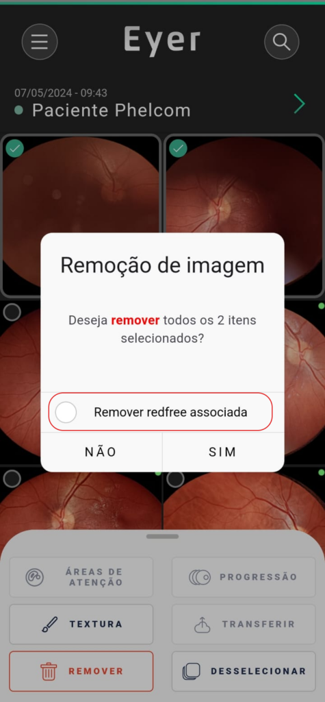 Help Excluindo Imagens
