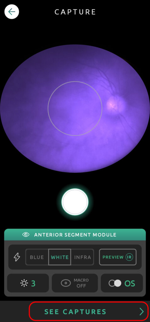 Help Capture Screen Anterior Segment 11