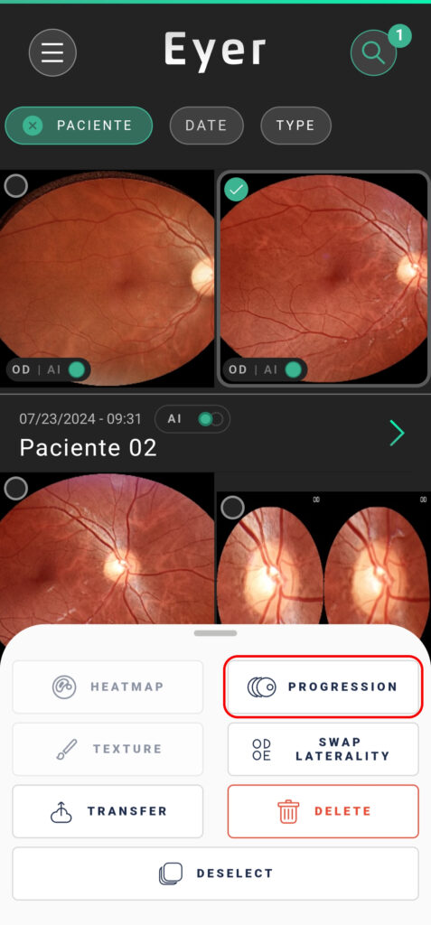 Help Patient Progression 01