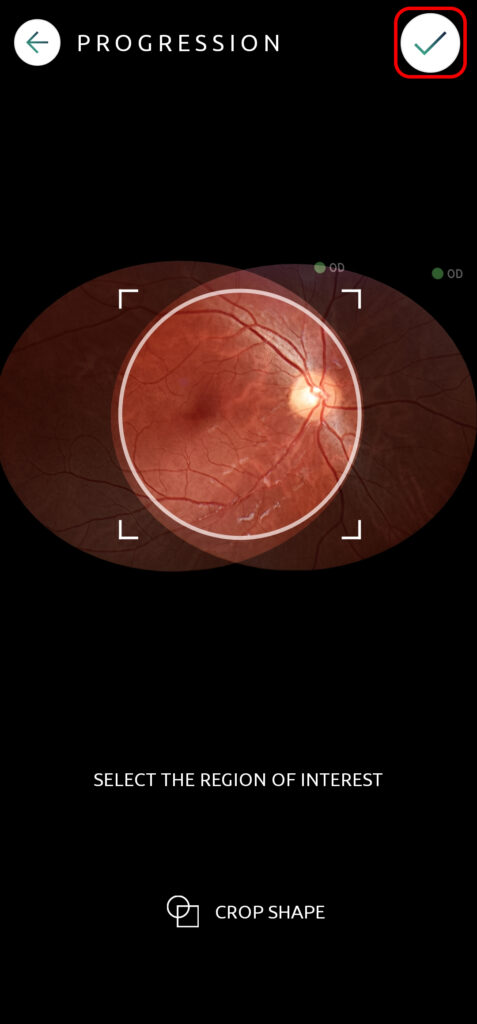 Help Patient Progression 02