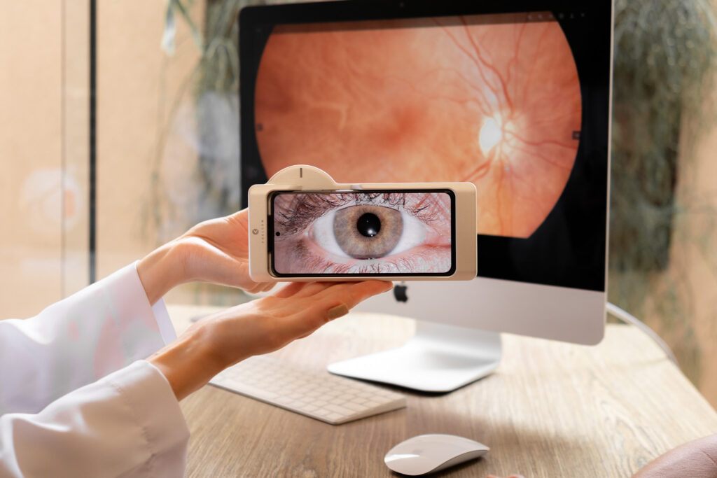 Img Retinografo Eyer2 Phelcom Blog Ebook