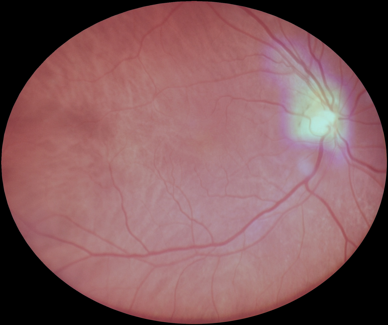 eyermaps_nao-obvia_02 Img Eyermaps 004