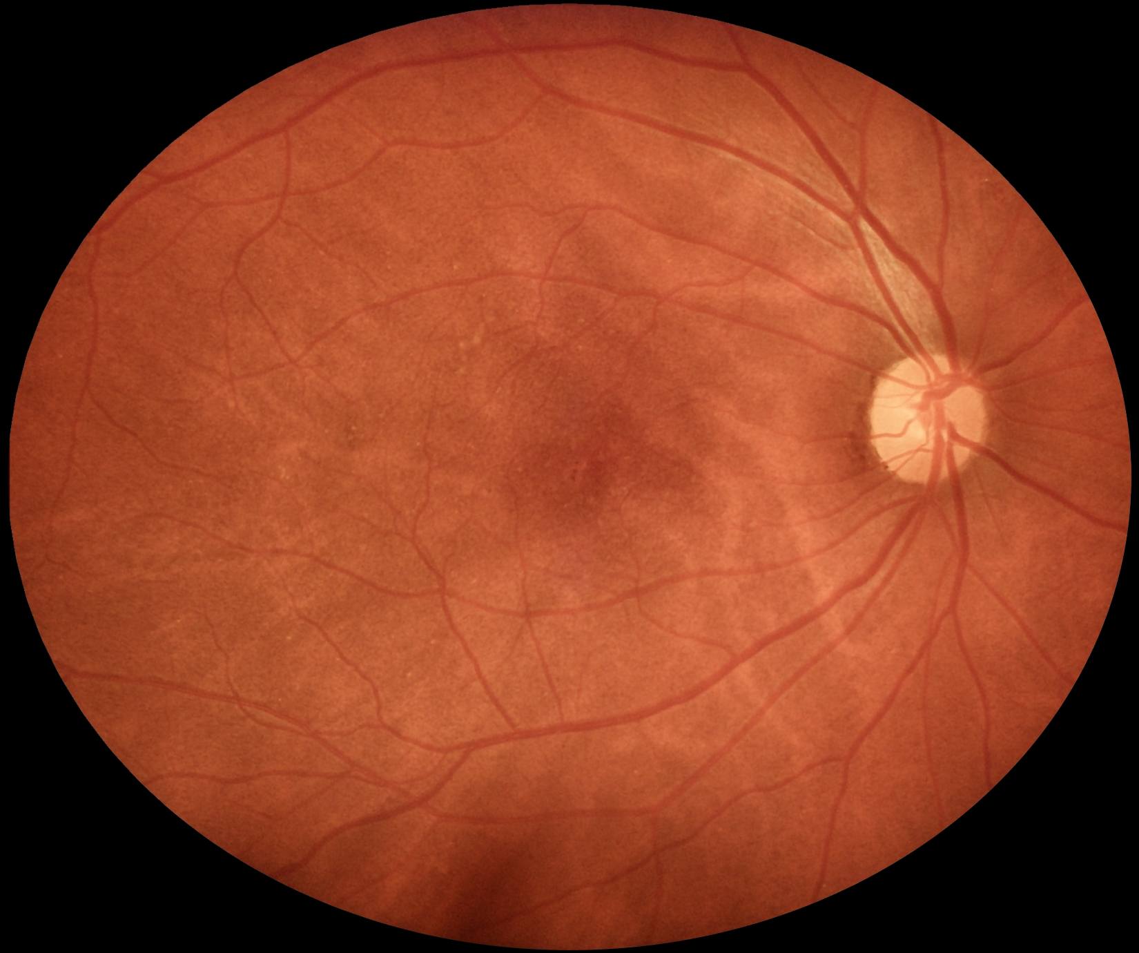 eyermaps_nao-obvia_05 Img Eyermaps 001