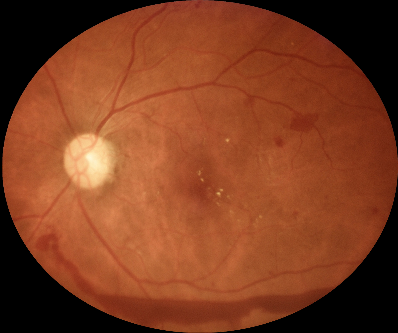 eyermaps_obvia_03 Img Eyermaps En óbvio4 A