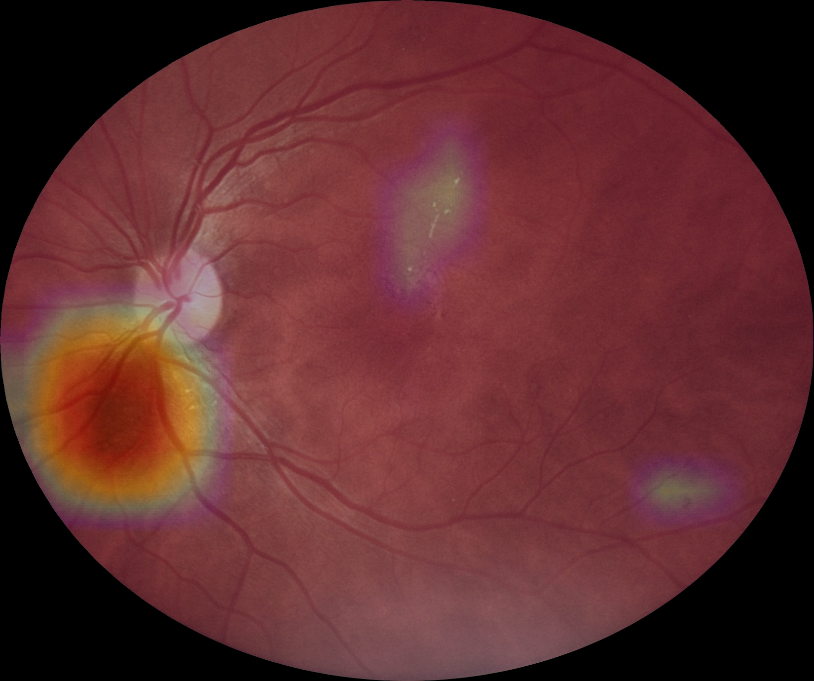 eyermaps_obvia_04 Img Eyermaps En óbvio3 B