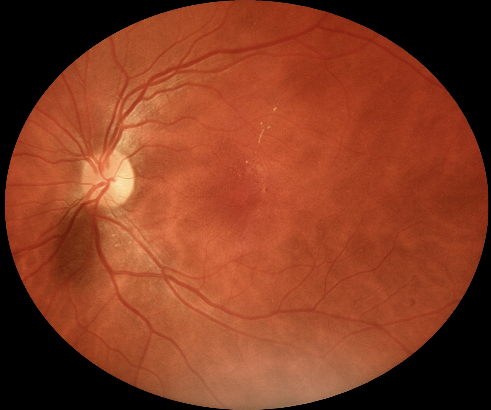 eyermaps_obvia_05 Img Eyermaps En óbvio3 A