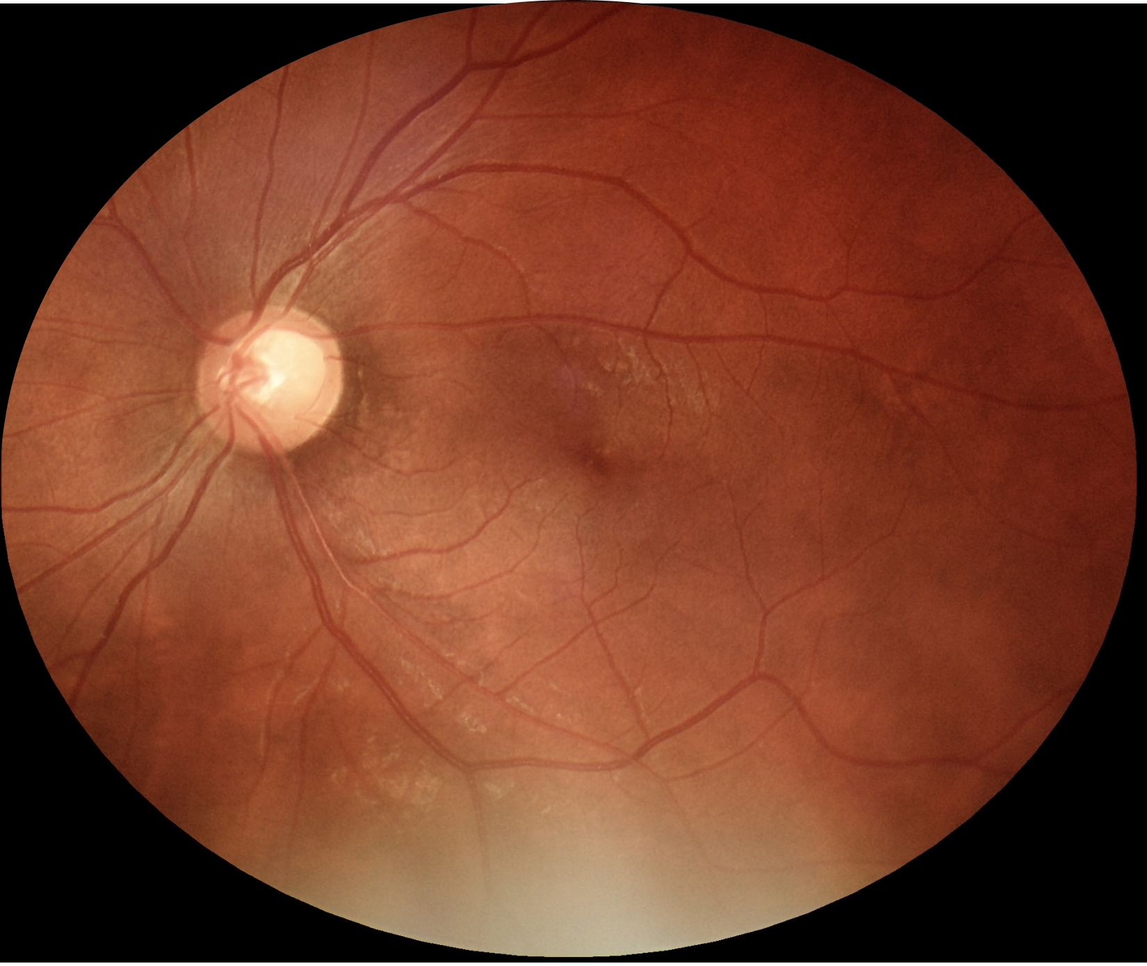 eyermaps_obvia_07 Img Eyermaps En óbvio4 A