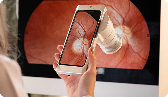 Retinógrafo Eyer2 e exame na tela do computador