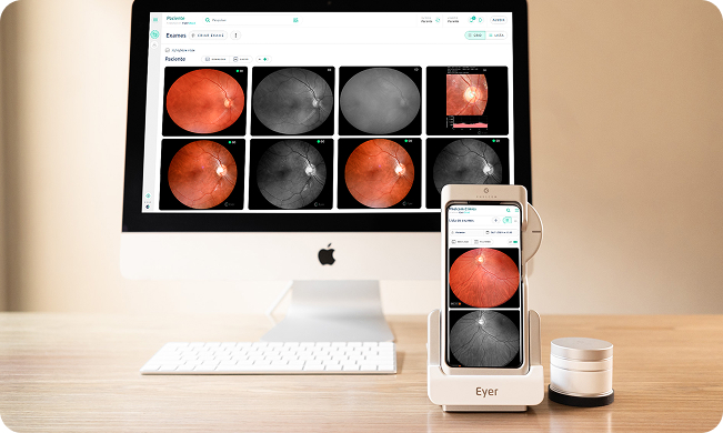Retinógrafo Eyer2 e exame na tela do computador