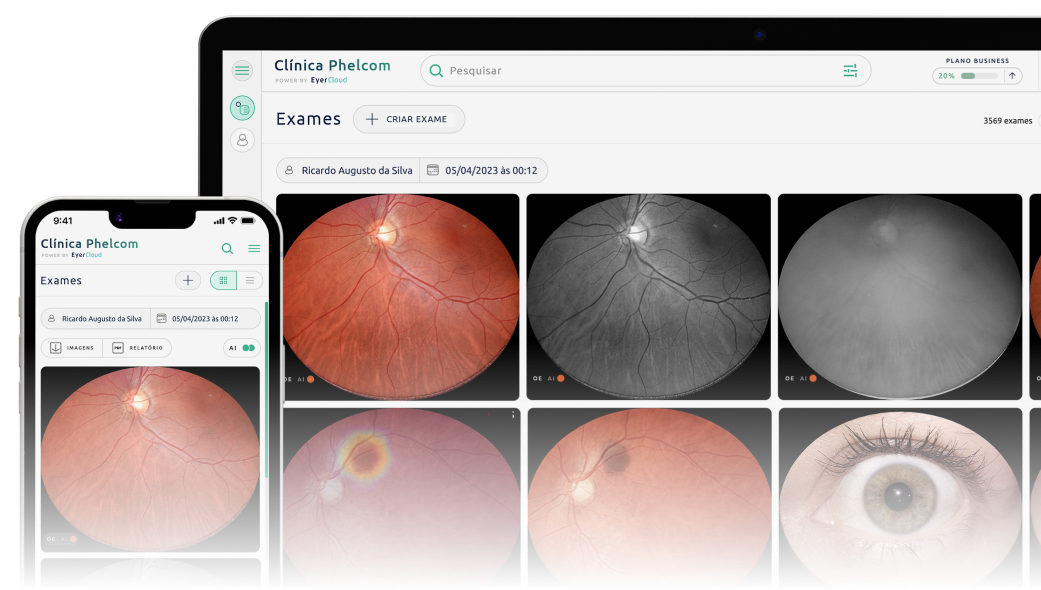 Telas do sistema em nuvem EyerCloud