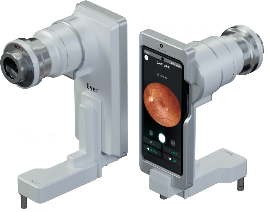 Eyer2 portable fundus camera with slit lamp adapter.