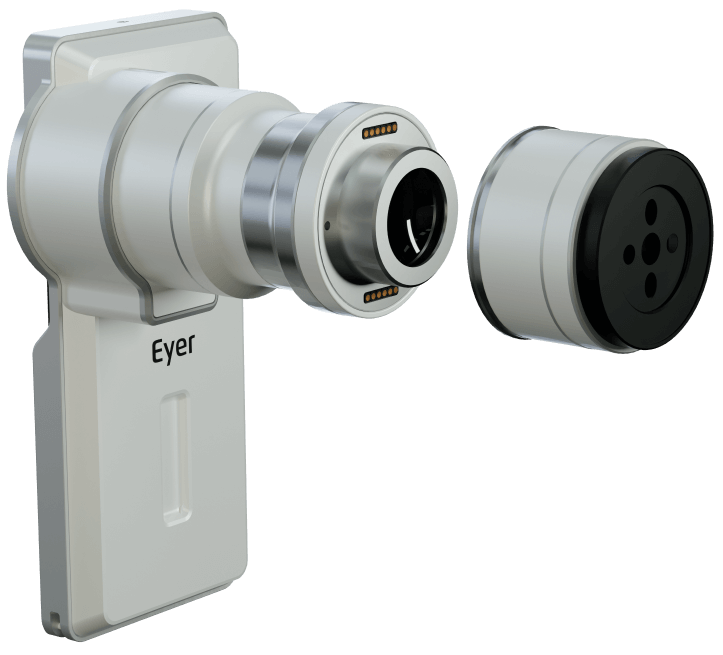 Eyer2 fundus camera with ocular surface module.
