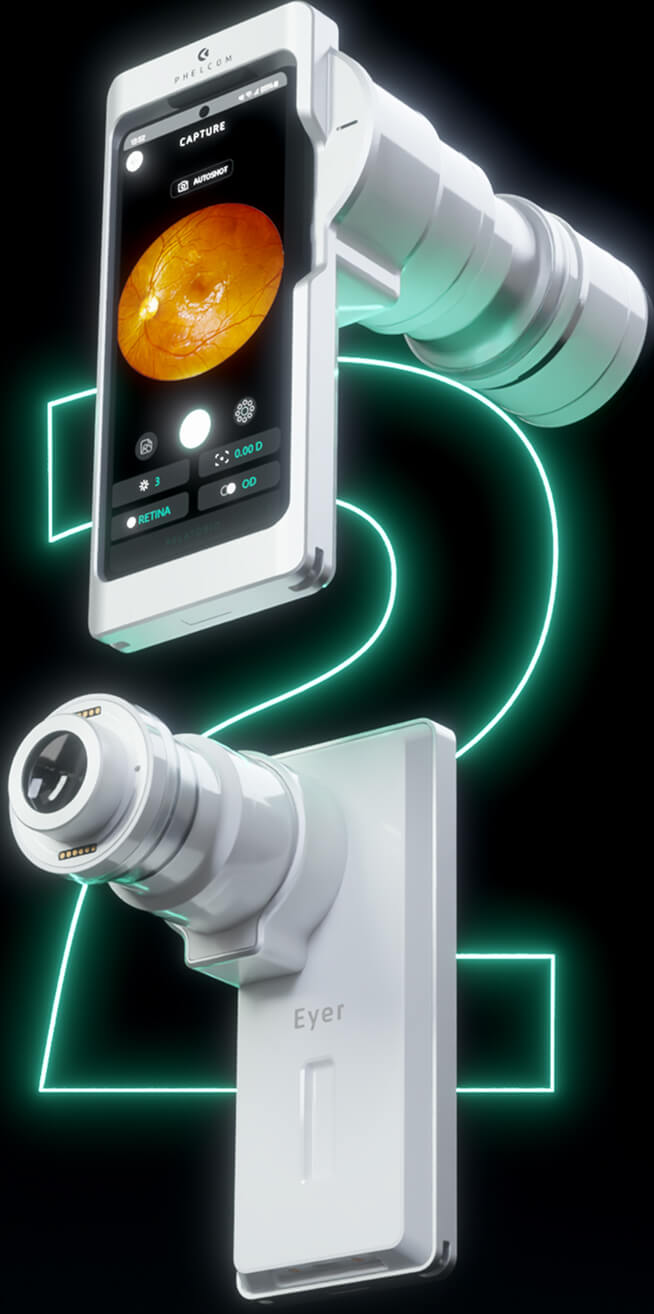 Eyer2 fundus camera specifications