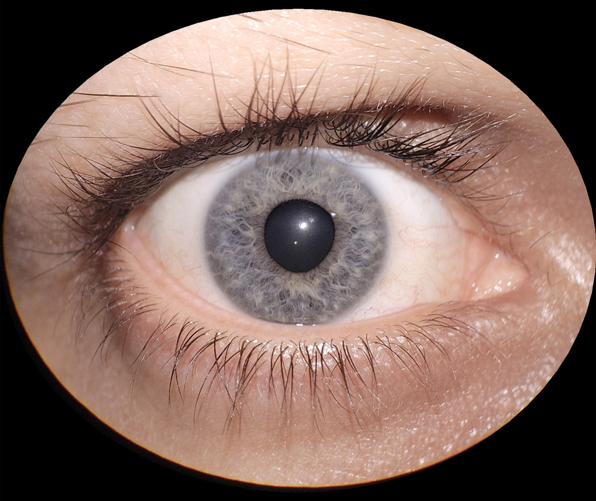 img_segmento_anterior_eyer2_02