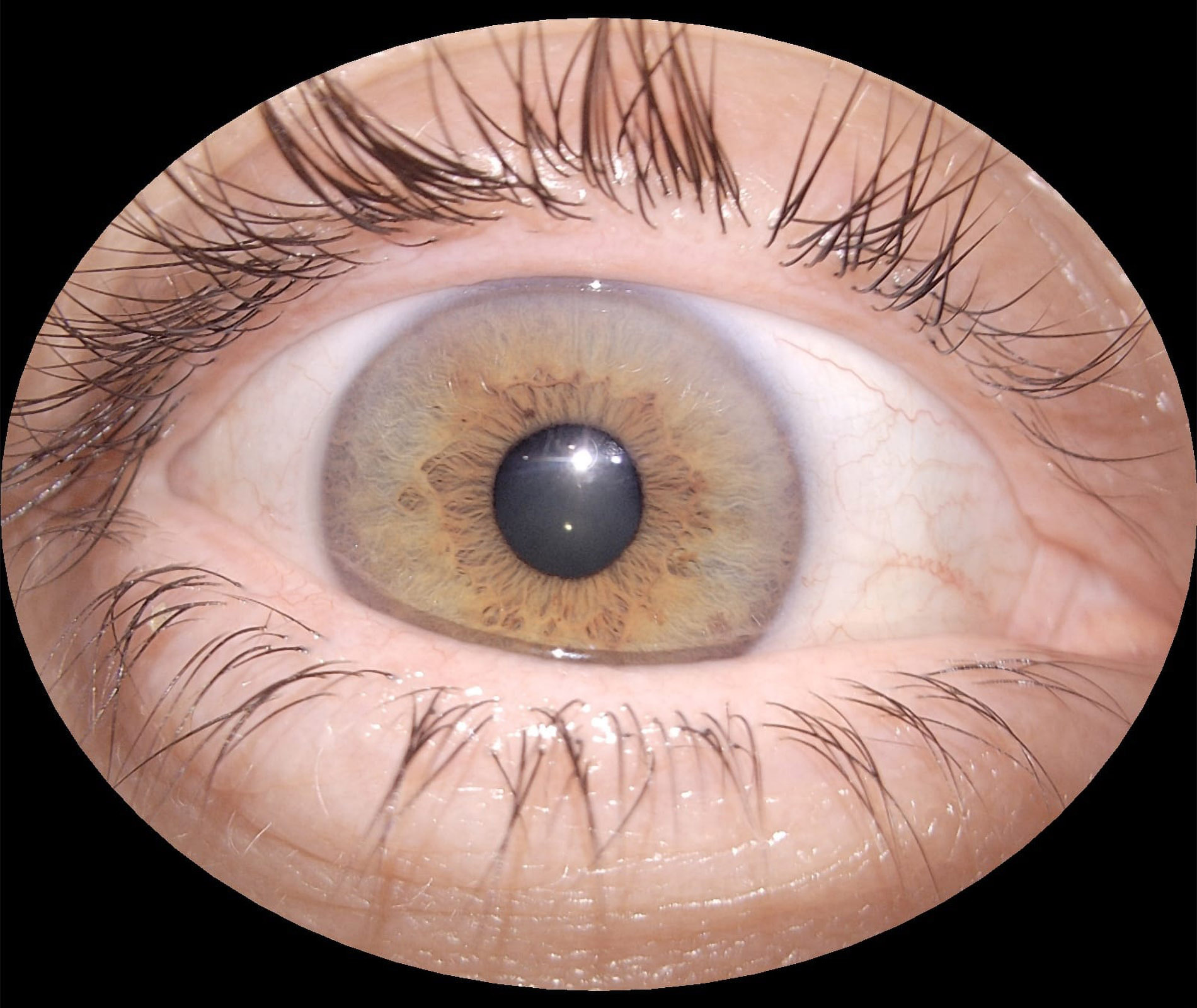 img_segmento_anterior_eyer2_04