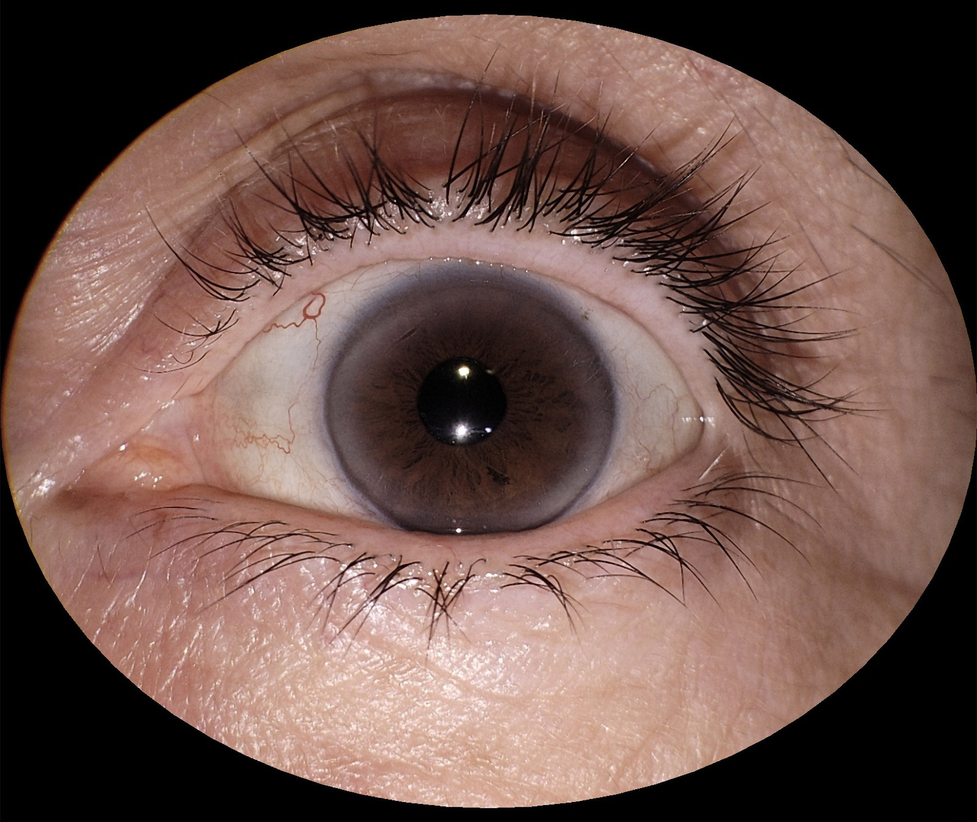 img_segmento_anterior_eyer2_05