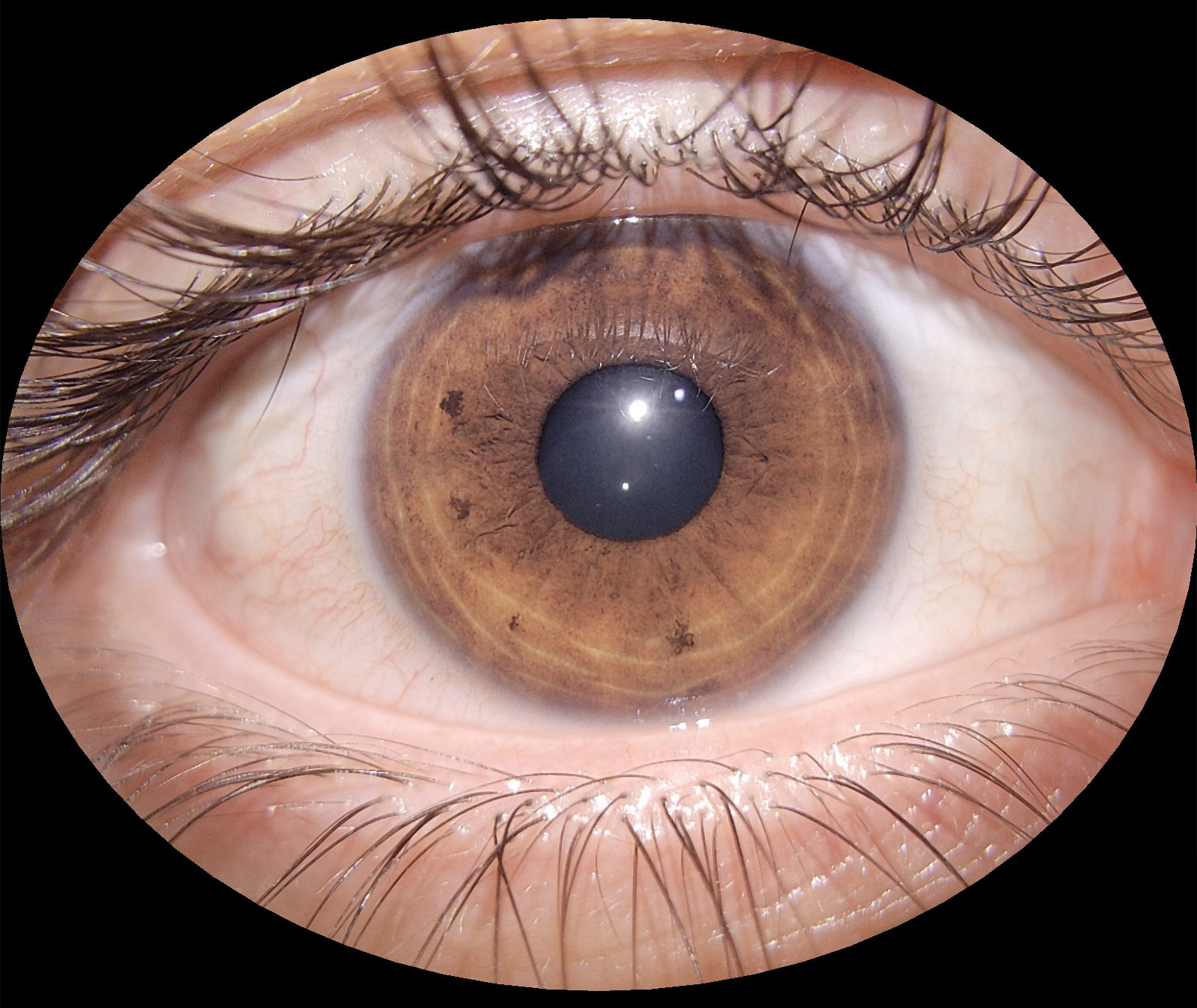 img_segmento_anterior_eyer2_08