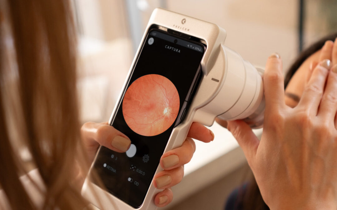 O oftalmoscópio na era digital: o poder da fotodocumentação